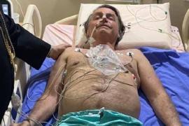 Presidente Jair Bolsonaro é internado com crise de soluço e dores abdominais Presidente Jair Bolsonaro é internado com crise de soluço e dores abdominais